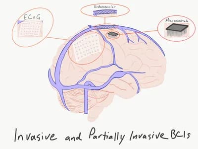 Brain-Computer Interfaces