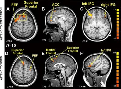 Functional MRI (fMRI)