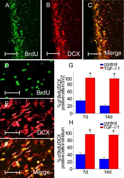 Adult Neurogenesis
