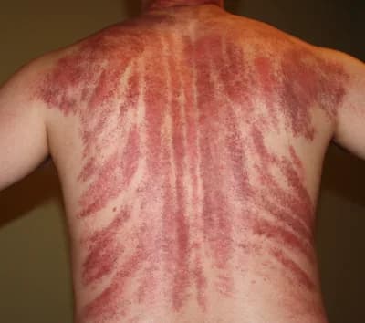 Gua Sha