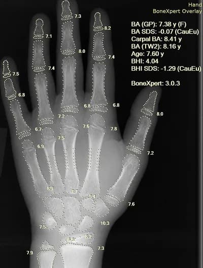 AI-Powered Medical Imaging Diagnosis