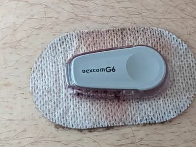 Dexcom Stelo