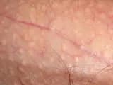 #1 The Dermatologist's Minimal Three-Step (Cleanser, Moisturizer, SPF) — Top 10 Best Skincare Routines