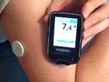 #3 Continuous Glucose Monitors for Non-Diabetics — Top 10 Wellness Trends Actually Backed by Science in 2026