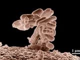 #3 Germ Theory (1860s) — Understanding That Tiny Organisms Kill — Top 10 Medical Breakthroughs That Changed the Course of Human History