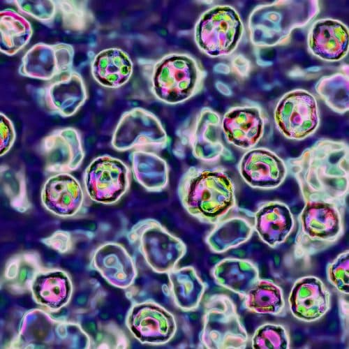 #6 Unvaccinated Pennsylvania woman died of measles complications, coroner says — Top 10 Ars Technica — Latest — September 14, 2026