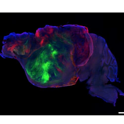 #7 Researchers swap in human brain cells for a mouse's cortex — Top 10 Ars Technica — Latest — September 17, 2026