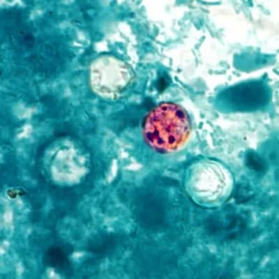 #5 Trump admin shelves Cyclospora research despite record-breaking outbreak — Top 10 Ars Technica — Latest — September 1, 2026
