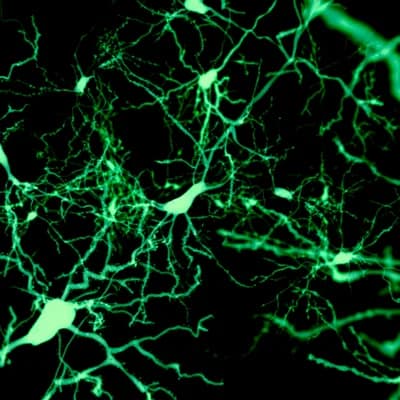 #6 Finding the cells that put our brain to sleep — Top 10 Ars Technica — Latest — September 19, 2026